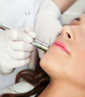 Microdermabrasion